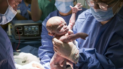 Es soll der erste solche Fall in Großbritannien gewesen sein. (Foto: Womb Transplant Uk/PA Media/dpa)