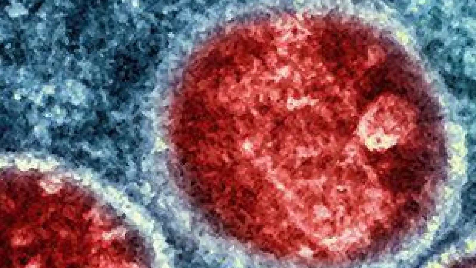 Bislang sieht das Robert-Koch-Institut keine Anzeichen zur Besorgnis. (Foto: -/National Institute of Allergy and Infectious Diseases/dpa)