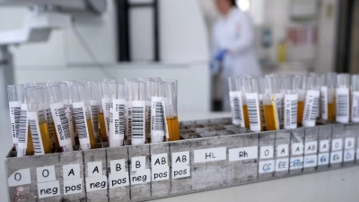 Blut ist nicht gleich Blut: Entscheidend für die Einsortierung in eine Blutgruppe ist, welche Antigene sich auf der Hülle der roten Blutkörperchen befinden. (Foto: Sven Hoppe/dpa/dpa-tmn)