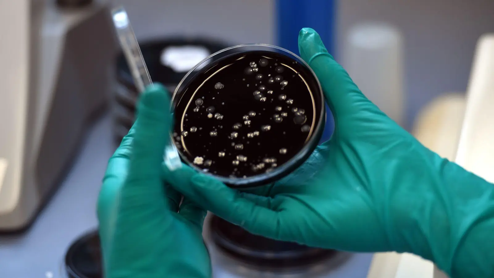 Nach einem Legionellen-Ausbruch in Ulm sind zwei Menschen gestorben. (Symbolbild)  (Foto: picture alliance / dpa)