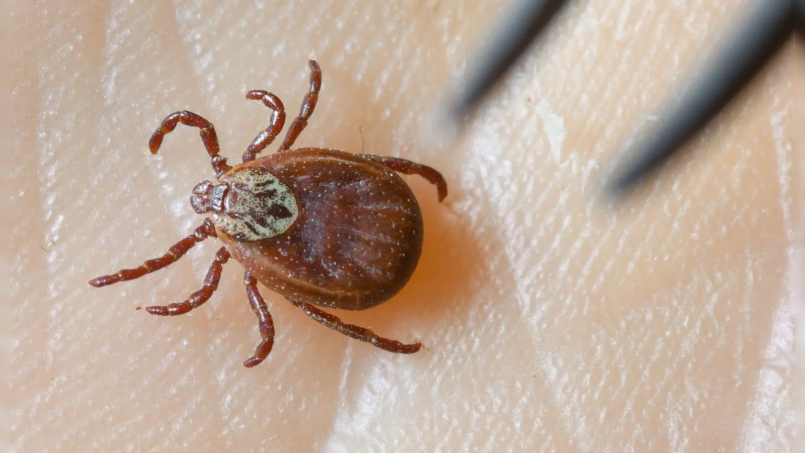 Zecken übertragen FSME und Borreliose. (Archivbild) (Foto: Patrick Pleul/dpa-Zentralbild/dpa)