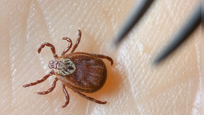 Zecken sind inzwischen ganzjährig aktiv, sie erobern selbst kühle Berglagen und verbreiten das FSME-Virus in ganz Deutschland.(Symboldbild)  (Foto: Patrick Pleul/dpa-Zentralbild/dpa)