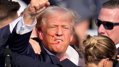 Trump wurde bei dem Attentat im Juli am Ohr verletzt. (Archivbild) (Foto: Gene J. Puskar/AP/dpa)