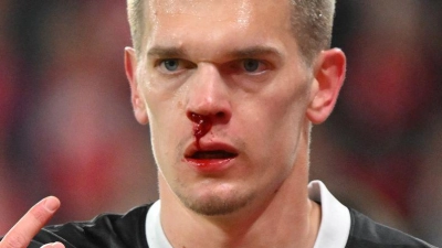 Musste immer wieder behandelt werden: Matthias Ginter. (Foto: Torsten Silz/dpa)