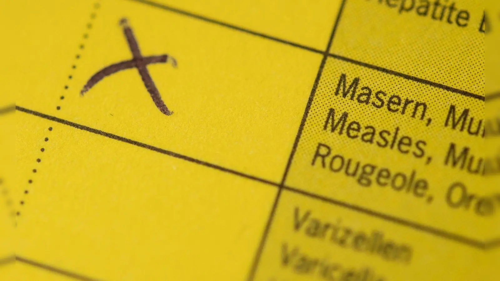 In einem Schnellrestaurant im Landkreis Erding gibt es einen Masernfall (Archivbild) (Foto: Marius Becker/dpa)