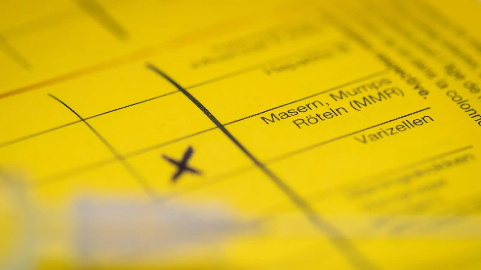 Bei Masern zeigt sich erst oft Fieber, bevor später ein Hautausschlag dazukommt. (Symbolbild) (Foto: Friso Gentsch/dpa)