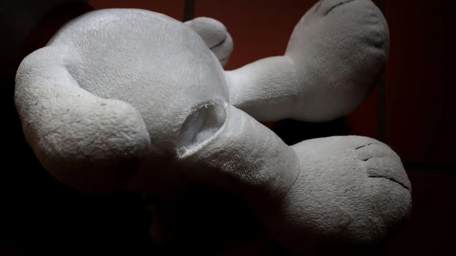 Ob das Kind bleibende Schäden hat, ist noch ungewiss. (Symbolbild) (Foto: Karl-Josef Hildenbrand/dpa)