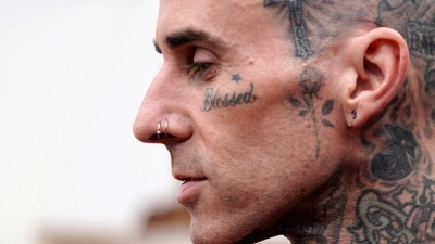 Travis Barker geht davon aus, dass er in ein paar Wochen wieder fit ist. (Archivbild) (Foto: Jae C. Hong/Invision/AP/dpa)