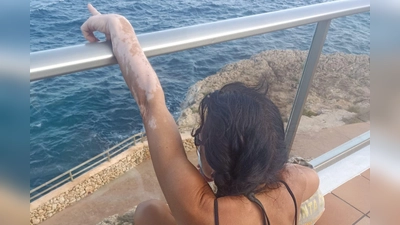 Belinda R. hat gelernt mit ihrer Erkrankung zu leben und sich ihren Lebensmut bewahrt. Heute genießt sie auch die Sonne wieder. (Foto: Privat)