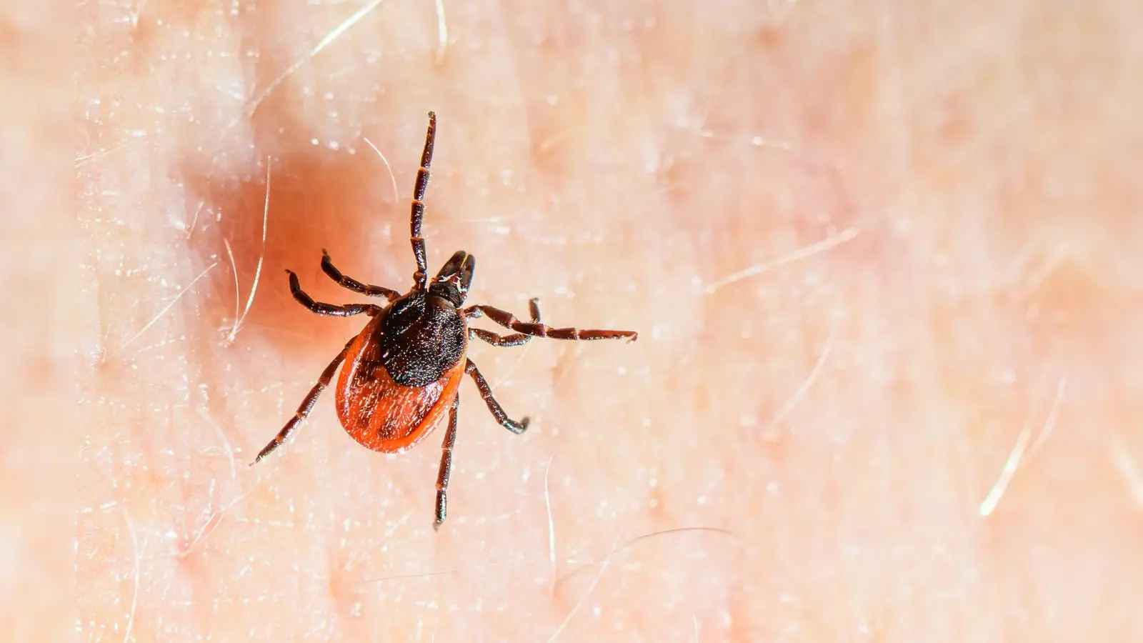 Der Gemeine Holzbock ist die häufigste Zeckenart in Deutschland und auch die, die hauptsächlich FSME und Borreliose auf den Menschen übertragt. (Archivbild) (Foto: Patrick Pleul/dpa)