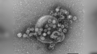 Das Norovirus ist sehr leicht übertragbar und gehört zu den weltweit häufigsten Erregern für plötzlich auftretenden Brechdurchfall.  (Foto: Gudrun Holland/RKI/Robert-Koch-Institut/dpa)