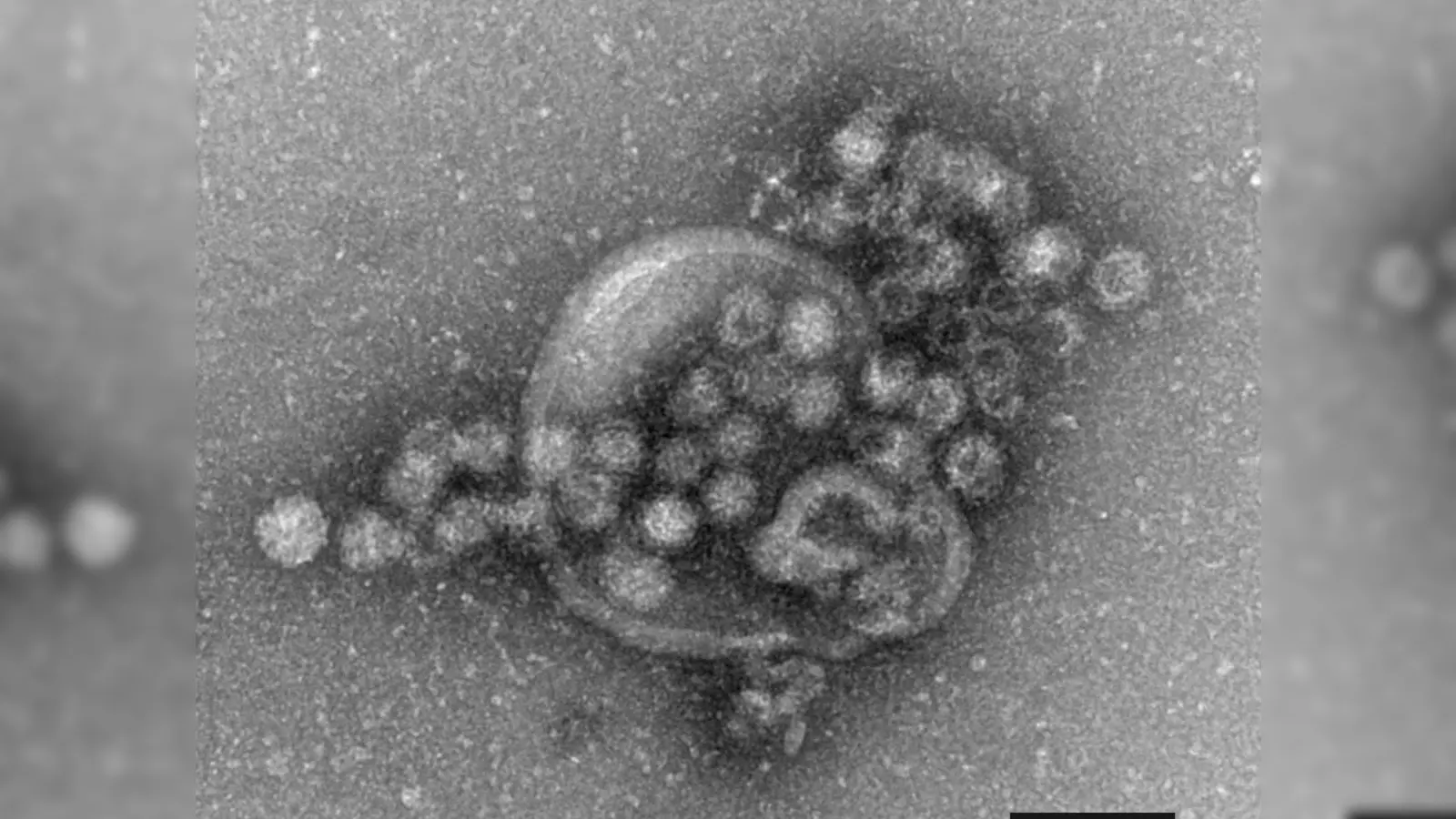 Das Norovirus ist sehr leicht übertragbar und gehört zu den weltweit häufigsten Erregern für plötzlich auftretenden Brechdurchfall.  (Foto: Gudrun Holland/RKI/Robert-Koch-Institut/dpa)