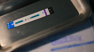 HIV-Diagnosen werden oft erst Jahre nach der Infektion gestellt. (Symbolbild) (Foto: Sebastian Gollnow/dpa)