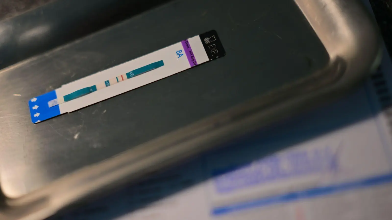 HIV-Diagnosen werden oft erst Jahre nach der Infektion gestellt. (Symbolbild) (Foto: Sebastian Gollnow/dpa)