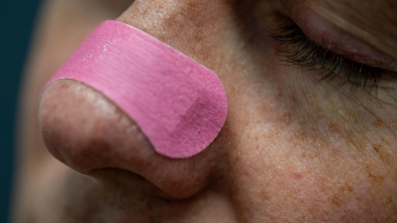 Nasenpflaster werden quer über den Nasenrücken geklebt und können die Nasenflügel sanft anheben, um die Atmung zu erleichtern. (Foto: Zacharie Scheurer/dpa-tmn)