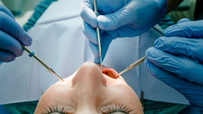 Machen die Weisheitszähne Probleme, müssen sie raus - ein Termin, vor dem viele Betroffene Angst haben.  (Foto: Markus Scholz/dpa-tmn)