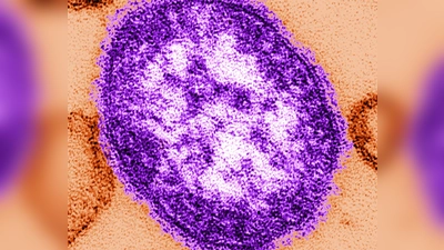 In den USA wurden seit Anfang des Jahres fast 1000 Masern-Fälle gemeldet. (Foto: Cynthia Goldsmith/Centers for Disease Contról and Prevention/dpa)