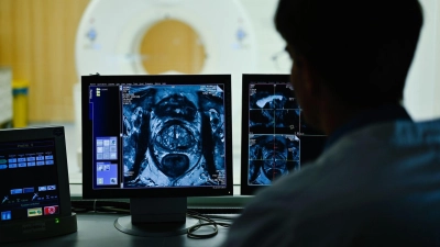 Nach dem Anfangsverdacht: Im Verlauf einer Diagnostik kommen auch bildgebende Verfahren zum Einsatz. (Foto: Uwe Anspach/dpa/dpa-tmn)