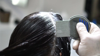 Gründliche Untersuchung ist entscheidend: Mit einem Läusekamm und einer Haarspülung lassen sich Läuse und Eier im feuchten Haar am zuverlässigsten aufspüren. (Foto: Britta Pedersen/dpa-Zentralbild/dpa-tmn)