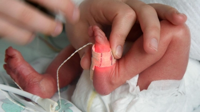 Bei überlebenden Frühchen kann die Gesundheit ein Leben lang beeinträchtigt sein. (Foto: Waltraud Grubitzsch/dpa)