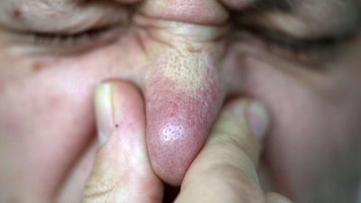 Die Abgasuntersuchung ergab laut dem Landratsamt, dass eine Gesundheitsgefährdung nicht besteht. (Symbolbild) (Foto: Oliver Berg/dpa)