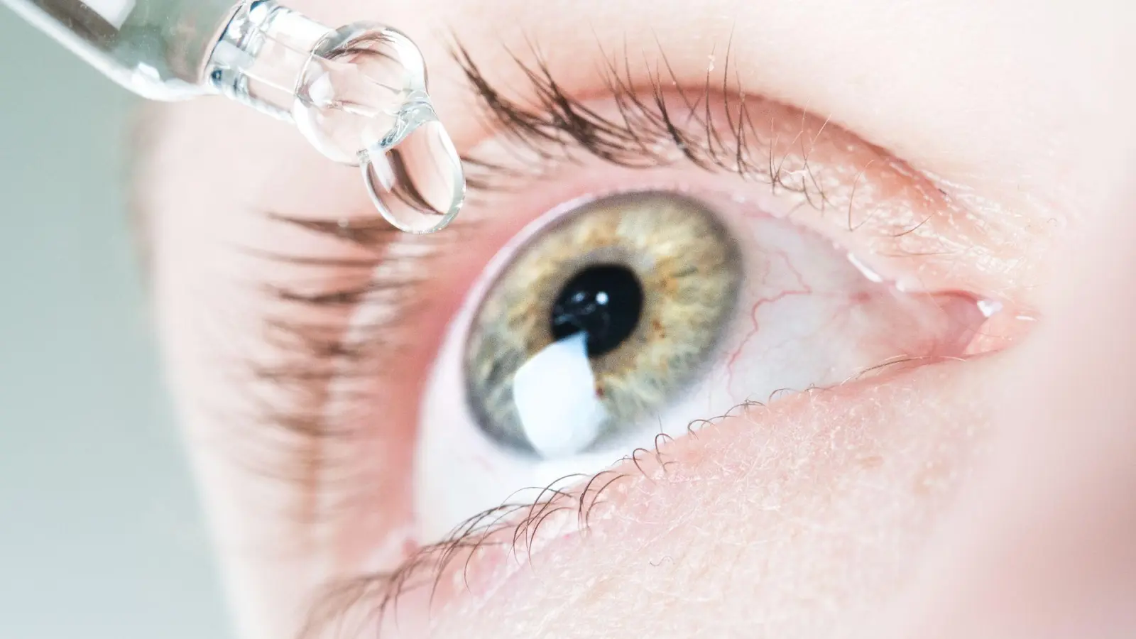 „Künstliche Tränen“ können bei trockenen Augen Linderung bringen. (Foto: Franziska Gabbert/dpa-tmn)