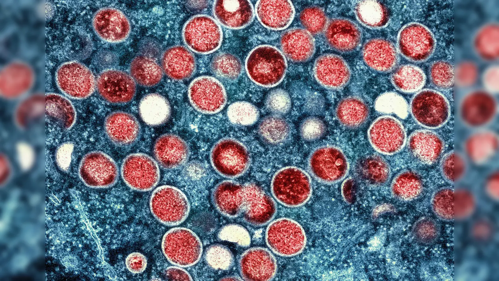 Eine eingefärbte Mikroskopaufnahme von Mpox-Partikeln. (Foto: National Institute of Allergy and Infectious Diseases/AP/dpa)