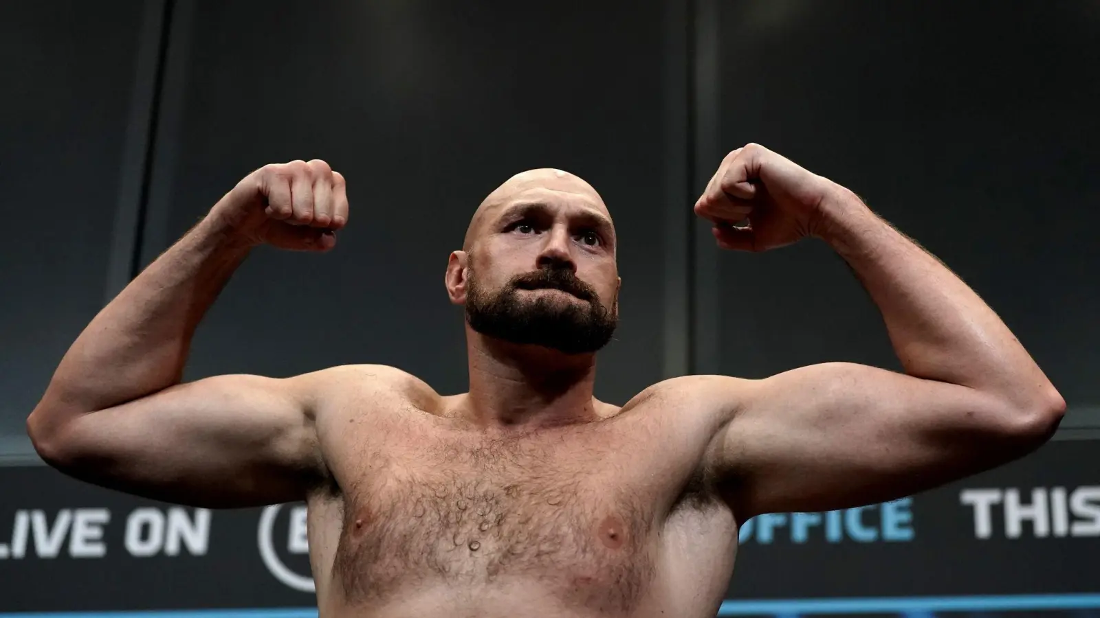 Tyson Fury zeigt während einer Pressekonferenz seine Muskeln. (Foto: Nick Potts/PA Wire/dpa)