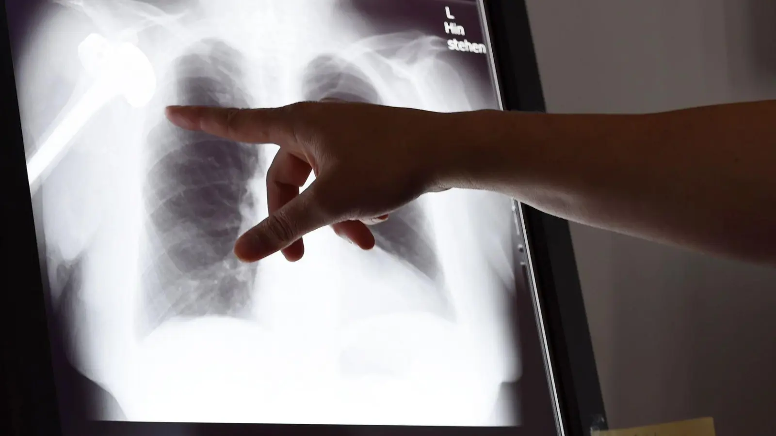 Über die Landesärztekammern kann man ein kostenloses Verfahren bei Gutachterkommissionen und Schlichtungsstellen einleiten, die eine ärztliche und juristische Bewertung des Falls vornehmen.  (Foto: Susann Prautsch/dpa/dpa-tmn)