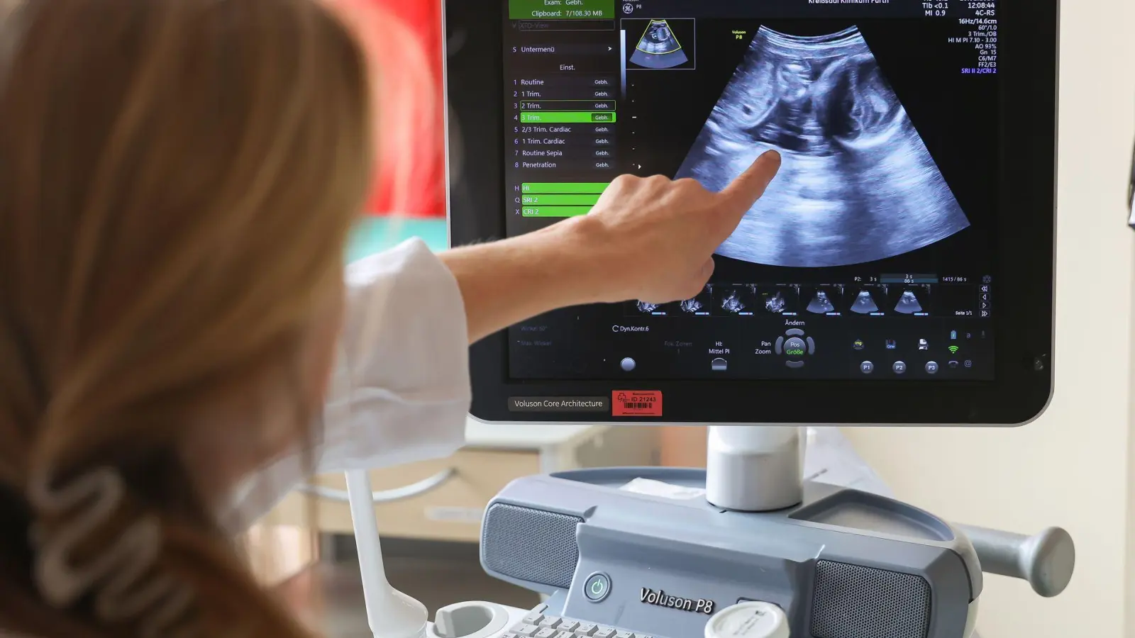 Auf dem Ultraschallbild ist laut der Ärztin zu sehen, dass Jasmin Schmidt wieder Zwillingsmädchen bekommt. (Foto: Daniel Löb/dpa)