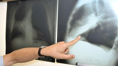 Im Winter weniger zu lüften, kann die Belastung mit krebserregendem Radon in der Wohnung erhöhen. (Archivbild) (Foto: Felix Hörhager/dpa)