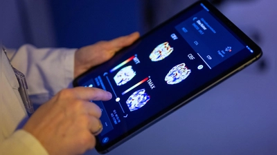 Gehirnbilder eines Patienten in einer KI-basierten App. Nach einer Deloitte-Umfrage sehen viele Bürgerinnen und Bürger den Einsatz von KI in der Medizin skeptisch, vor allem wenn es um die Therapie geht. (Symbolbild) (Foto: Monika Skolimowska/dpa)